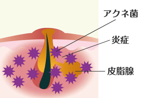 どうしてクレーターができるの？