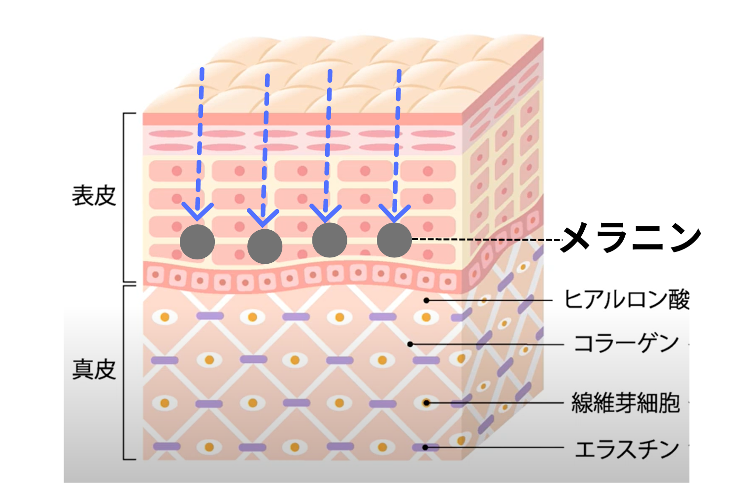 シミやくすみの治療方法とは？